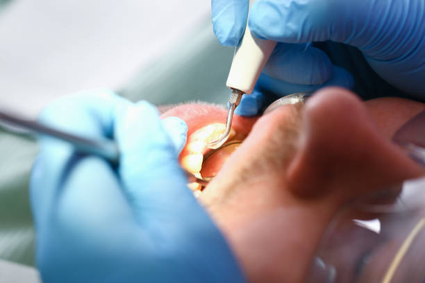 Best Emergency Dental Services for Seniors in Start, LA
