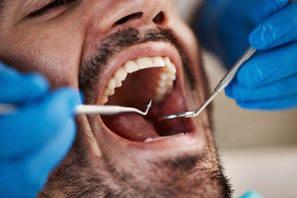 Best Mobile Emergency Dentist in Start, LA